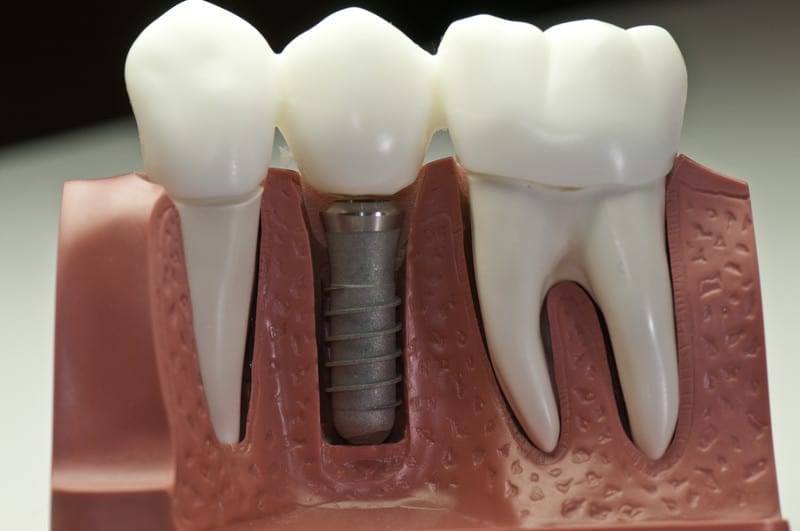 Interior of Toothology in Scottsdale for dental implants care