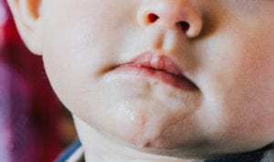 Closeup of a toddler with adequate saliva production has drool on his chin