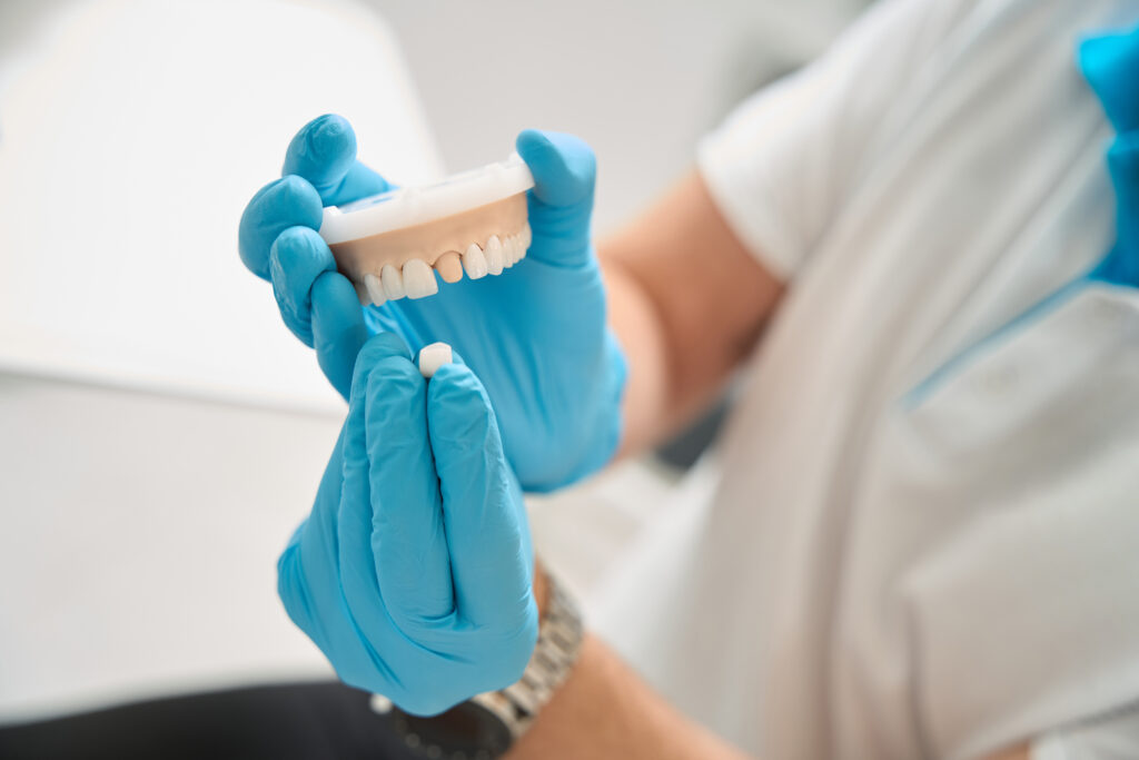 When Do You Need a Dental Crown? Signs to Know