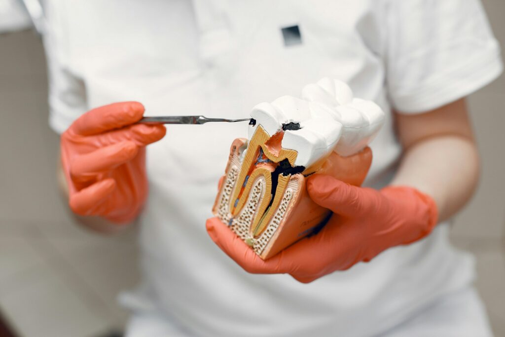 Root Canal Explained: What to Expect & Why