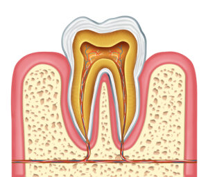 Signs You Need a Root Canal: Key Symptoms
