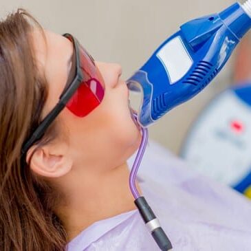 teeth-whitening-office